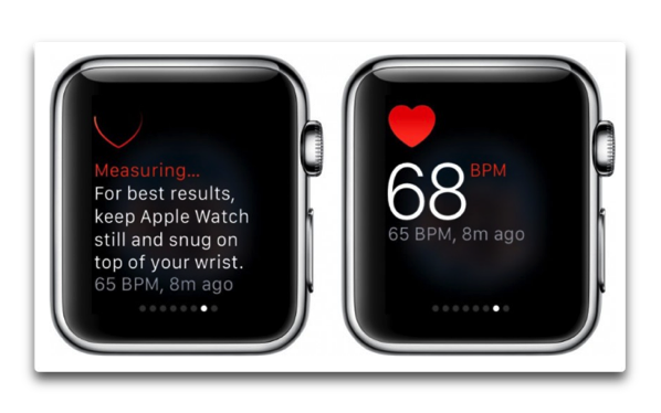 Apple、Apple Watchは心臓の異常を検出できるかどうかをテストしています