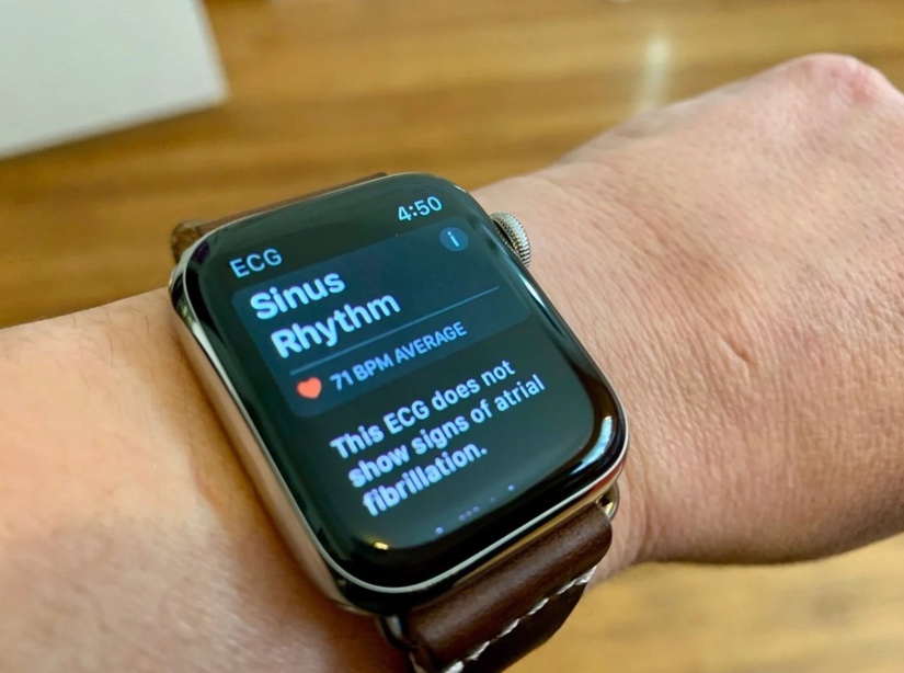 Apple、ECG機能に焦点を当てた新しいAppleWatch Series 6の広告をまもなく公開